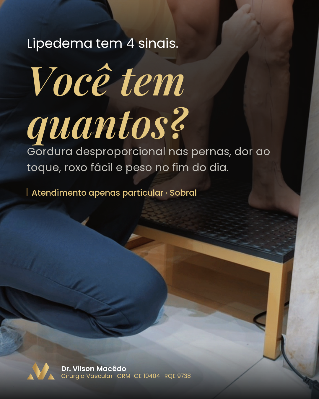 Lipedema tem 4 sinais. Você tem quantos?