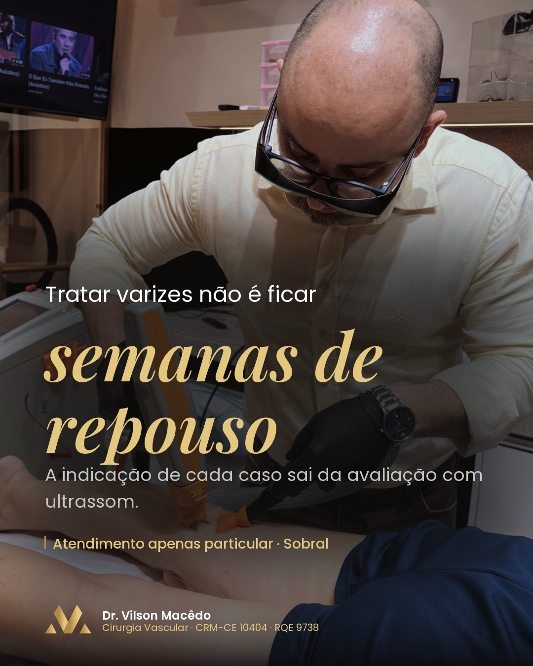 Tratar varizes não é ficar semanas de repouso.