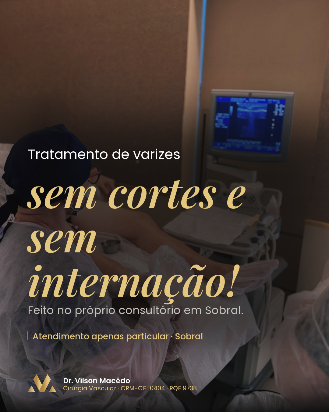 Tratamento de varizes sem cortes e sem internação! Feito no próprio consultório em Sobral.