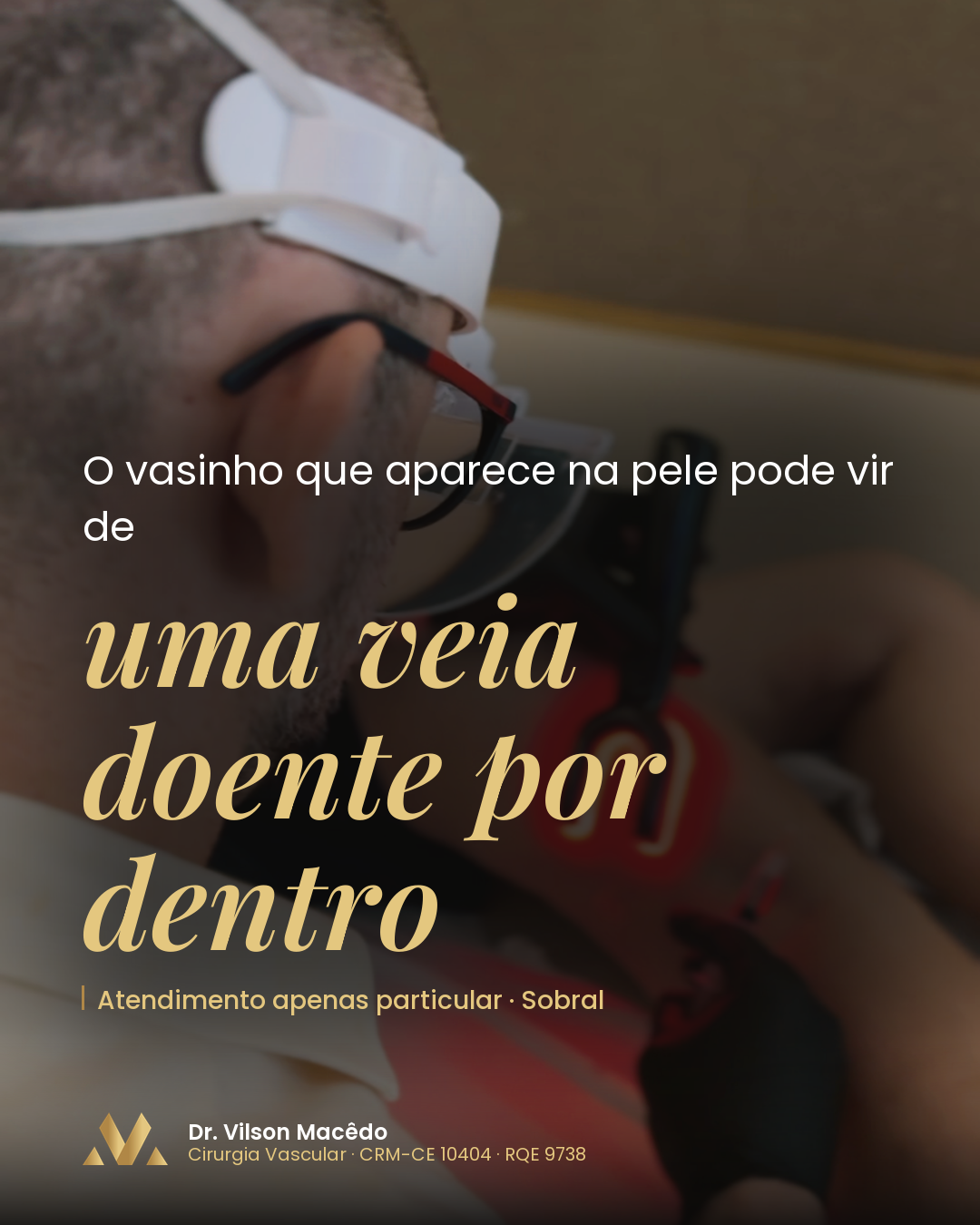 O vasinho que aparece na pele pode vir de uma veia doente por dentro.
