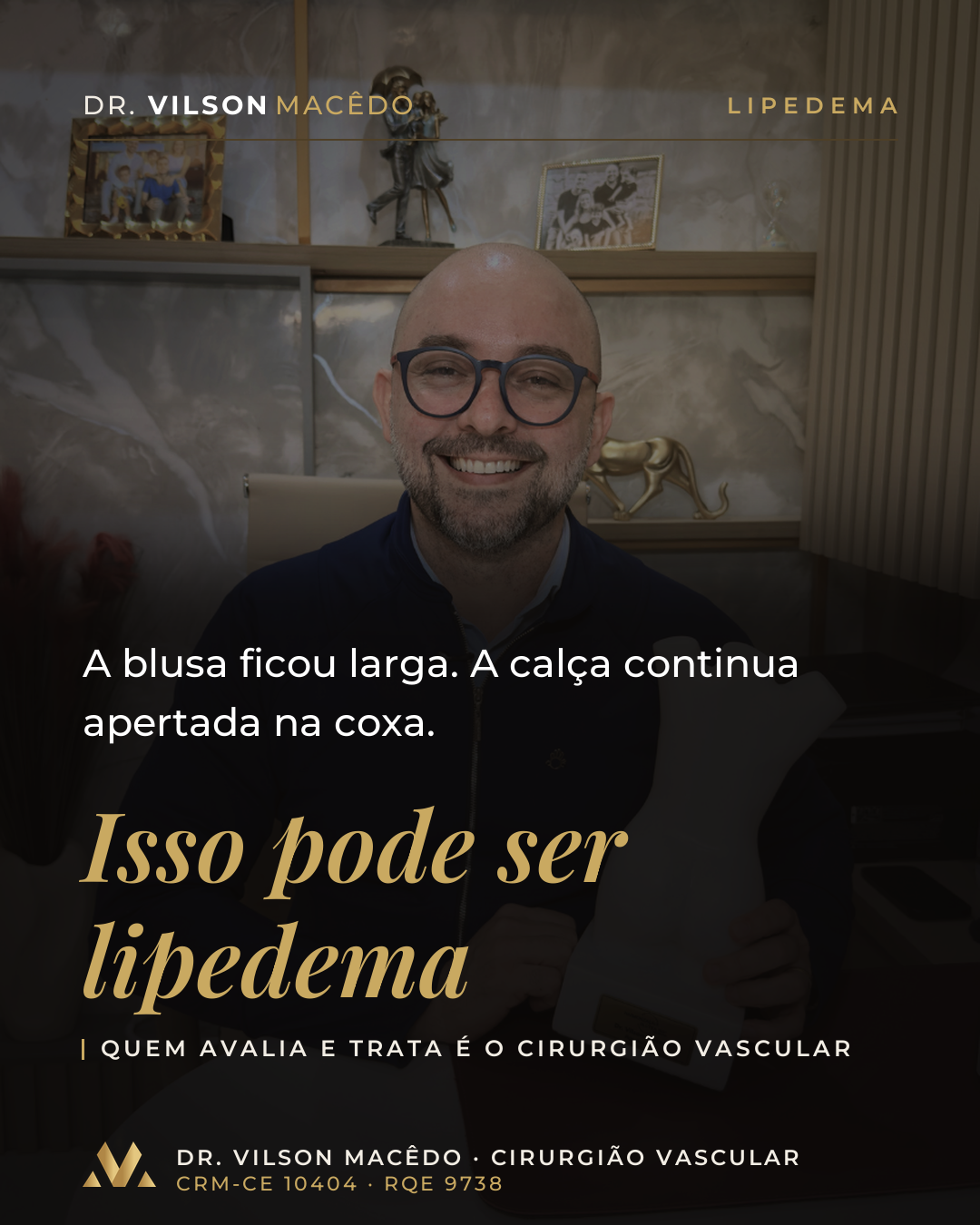 A blusa ficou larga. A calça continua apertada na coxa.