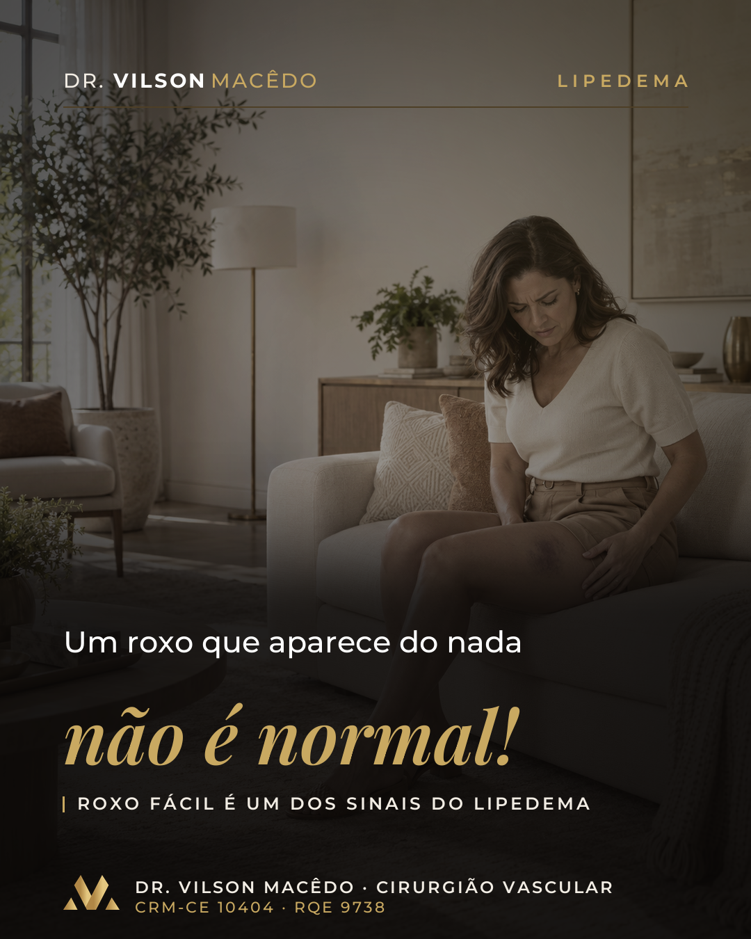 Um roxo que aparece do nada não é normal!