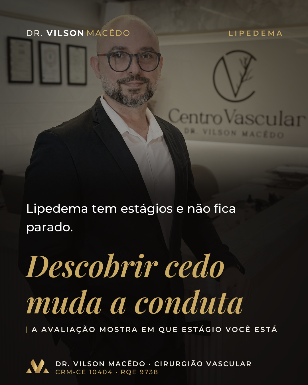 Lipedema tem estágios e não fica parado. Descobrir cedo muda a conduta.