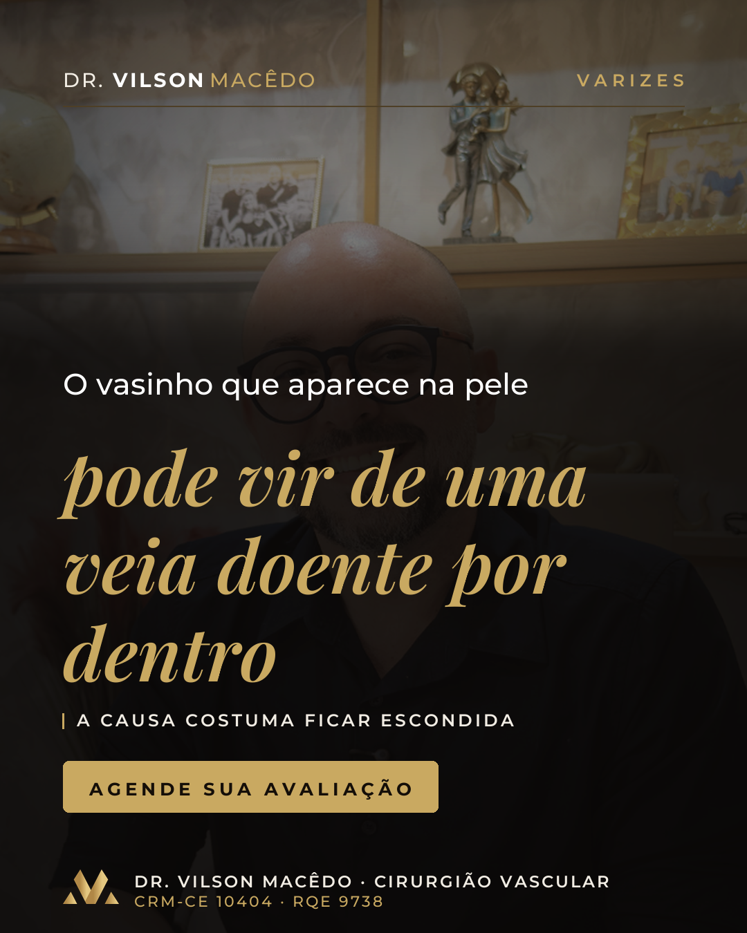 O vasinho que aparece na pele pode vir de uma veia doente por dentro.
