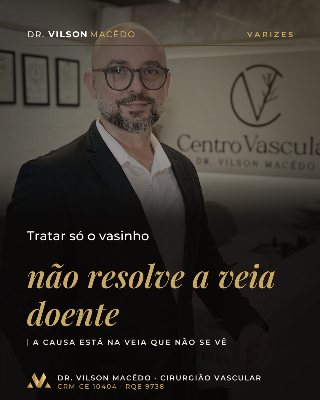 Tratar só o vasinho não resolve a veia doente.
